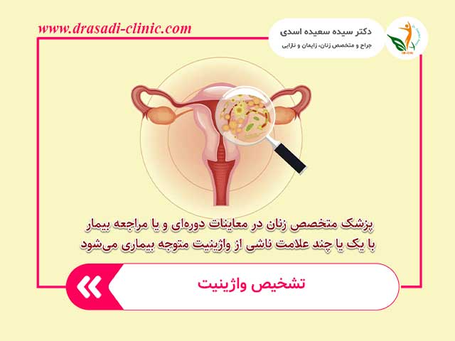 Diagnosis and treatment of vaginitis by a doctor 1 - آشنایی با دلایل و علائم واژینیت و روش تشخیص و درمان آن
