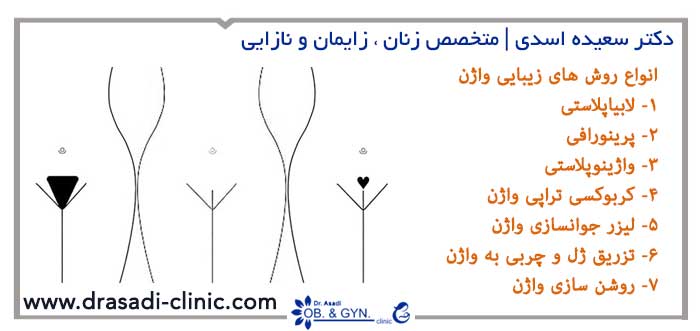 راههای زیباسازی واژن | متخصص زنان در شرق تهران راههای زیباسازی واژن | متخصص زنان در شرق تهران