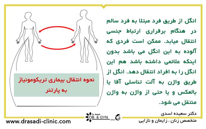 نحوه انتقال بیماری تریکومونیاز | دکتر سعیده اسدی٬ متخصص زنان نحوه انتقال بیماری تریکومونیاز | دکتر سعیده اسدی٬ متخصص زنان