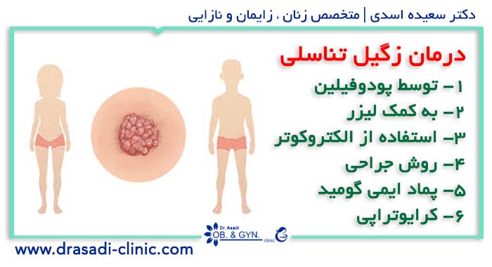 درمان زگیل تناسلی | دکتر سعیده اسدی٬ متخصص زنان در شرق تهران درمان زگیل تناسلی | دکتر سعیده اسدی٬ متخصص زنان در شرق تهران