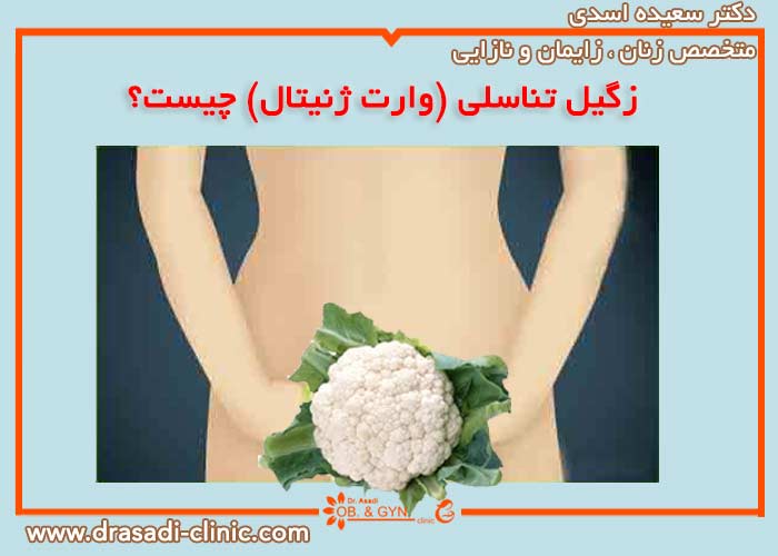 زگیل تناسلی چیست؟ | دکتر سعیده اسدی٬ متخصص زنان در شرق تهران زگیل تناسلی چیست؟ | دکتر سعیده اسدی٬ متخصص زنان در شرق تهران