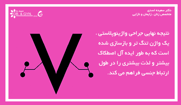 تنگ کردن واژن به روش جراحی واژینوپلاستی | دکتر سعیده اسدی٬ متخصص زنان در شرق تهران