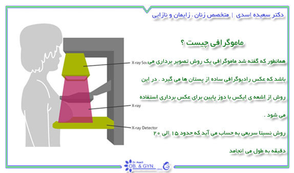 ماموگرافی چیست؟ | دکتر سعیده اسدی٬ متخصص زنان ماموگرافی چیست؟ | دکتر سعیده اسدی٬ متخصص زنان