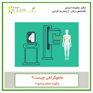 ماموگرافی چیست؟ | دکتر سعیده اسدی٬ متخصص زنان