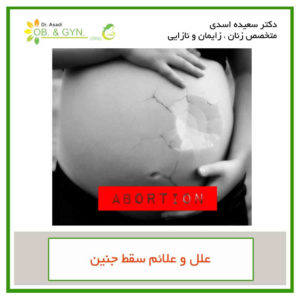 علل و علائم سقط جنین | دکتر سعیده اسدی٬ متخصص زنان