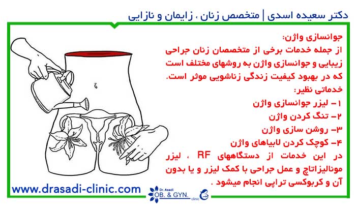 جوانسازی واژن توسط متخصص زنان جوانسازی واژن توسط متخصص زنان