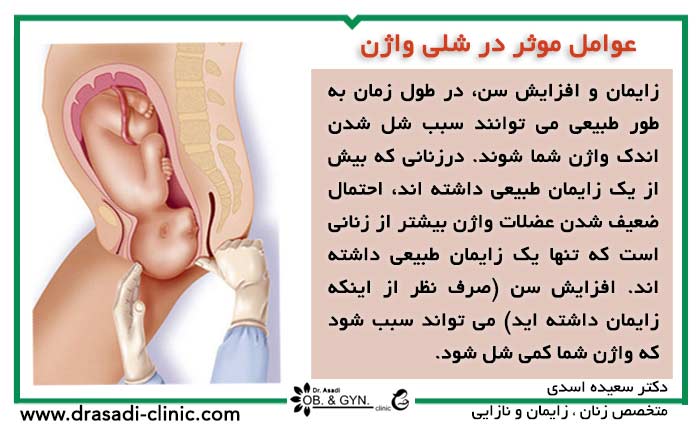 عوامل موثر در شلی واژن | دکتر سعیده اسدی٬ متخصص زنان در شرق تهران عوامل موثر در شلی واژن | دکتر سعیده اسدی٬ متخصص زنان در شرق تهران