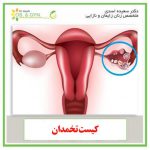 تخمدان 150x150 - 15 علت درد تخمدان در بارداری را بشناسید