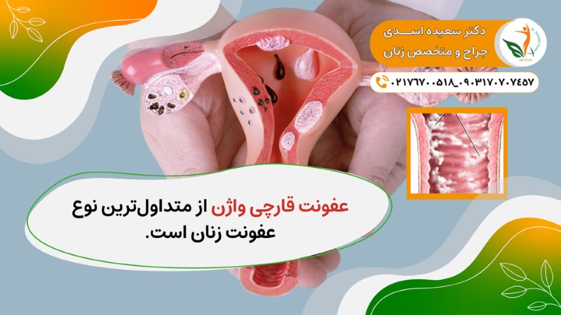 treatment of frequent vaginal infections 02 - درمان عفونت واژن