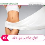 جراحی زیبایی واژن 150x150 - دکتر سعیده اسدی
