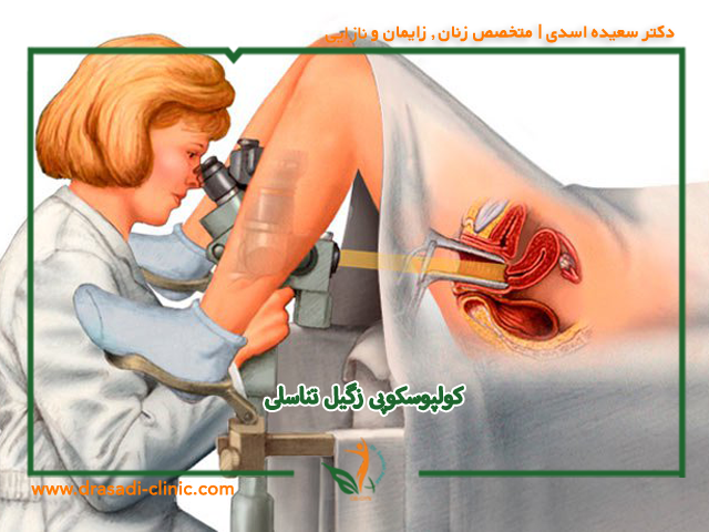 کولپوسکوپی زگیل تناسلی | دکتر سعیده اسدی متخصص زنان تهرانپارس
